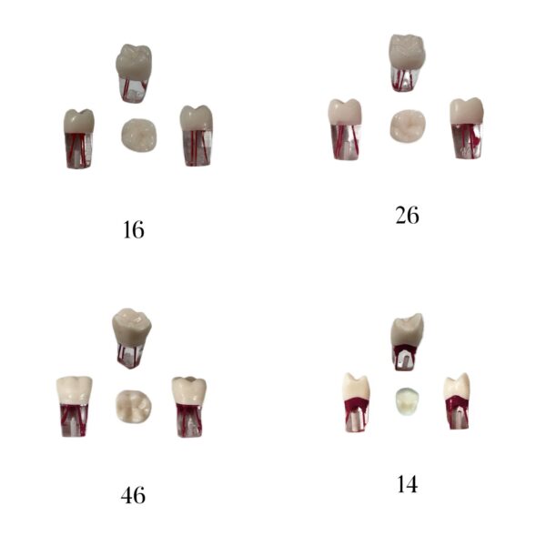 Pack Of 5 ENDO RCT Tooth