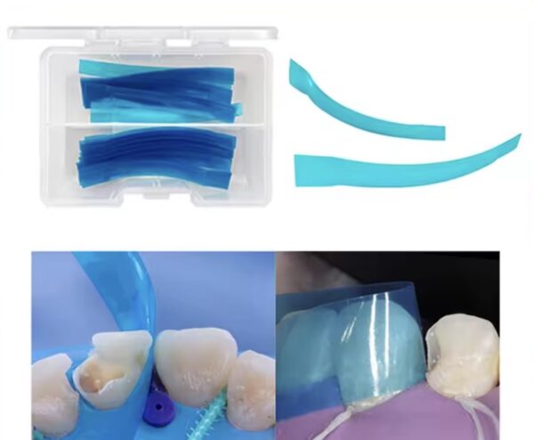 Dental Contoured Anterior Matrix Strips – Pack of 5 (Blue Transparent) - Image 2