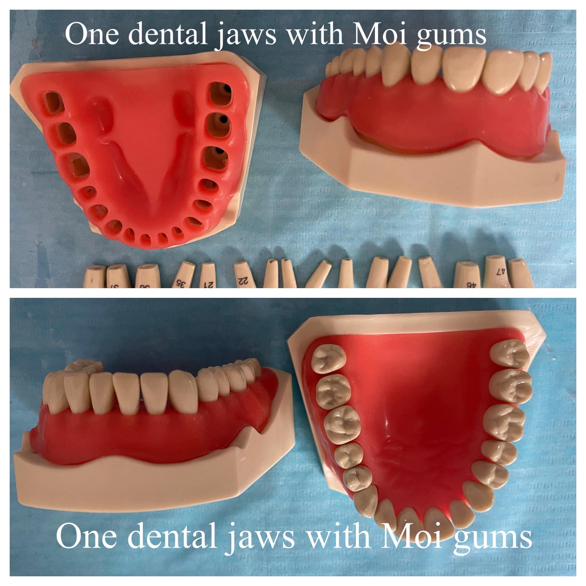 ADC Replacement Pink Gingivae – Upper & Lower Options Available - Image 4